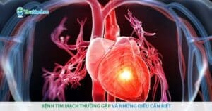 Bệnh lý tim mạch thường gặp và những điều cần biết