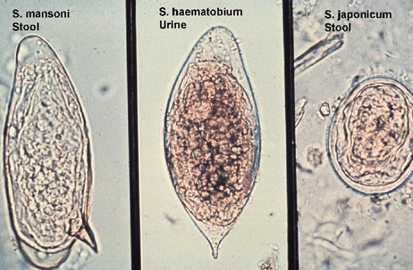 Trứng sán máng nhìn dưới kính hiển vi