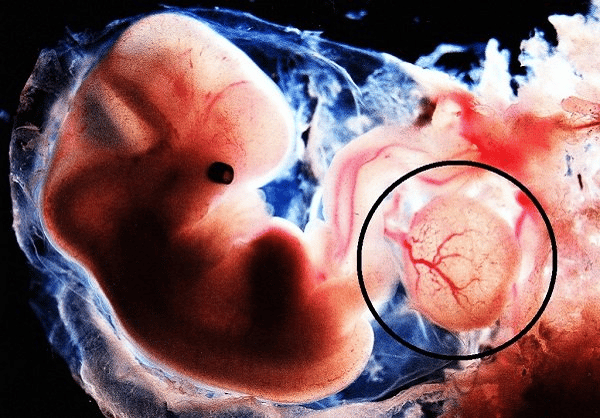  Yolksac có thể nhìn thấy được qua siêu âm khi thai hơn 5 tuần tuổi