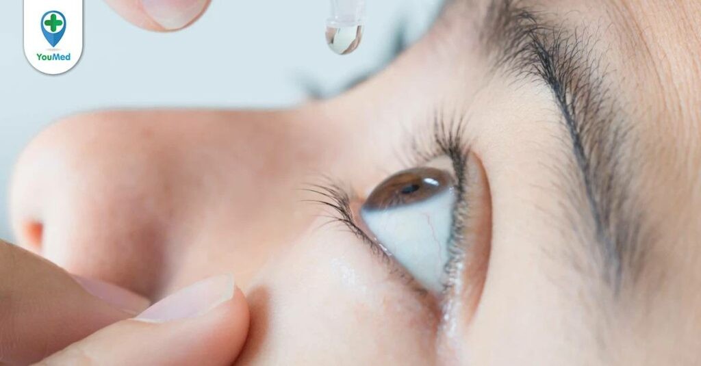 Phân loại các loại thuốc nhỏ mắt tốt theo nhóm bệnh