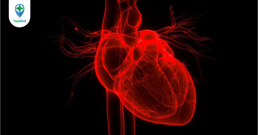Thấp tim: Nguyên nhân, triệu chứng chẩn đoán và điều trị