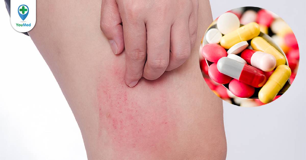 Bị dị ứng thuốc kháng sinh nên làm gì ngay lập tức?