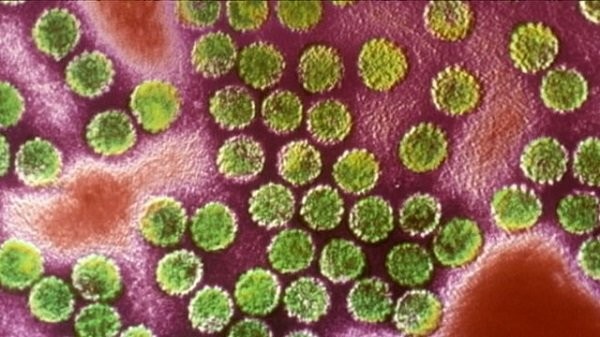 hình ảnh mô phỏng virus HPV 