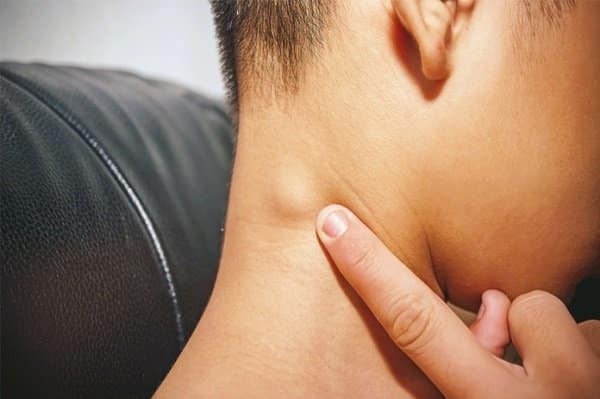 Nổi hạch sau gáy là triệu chứng cho thấy có nhiễm trùng hoặc sự xâm nhập của tác nhân lạ vùng đầu cổ