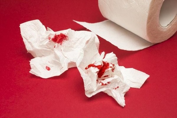 Tiêu ra máu dính trên giấy vệ sinh