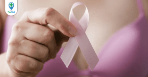 Nhận biết và điều trị ung thư vú giai đoạn 2