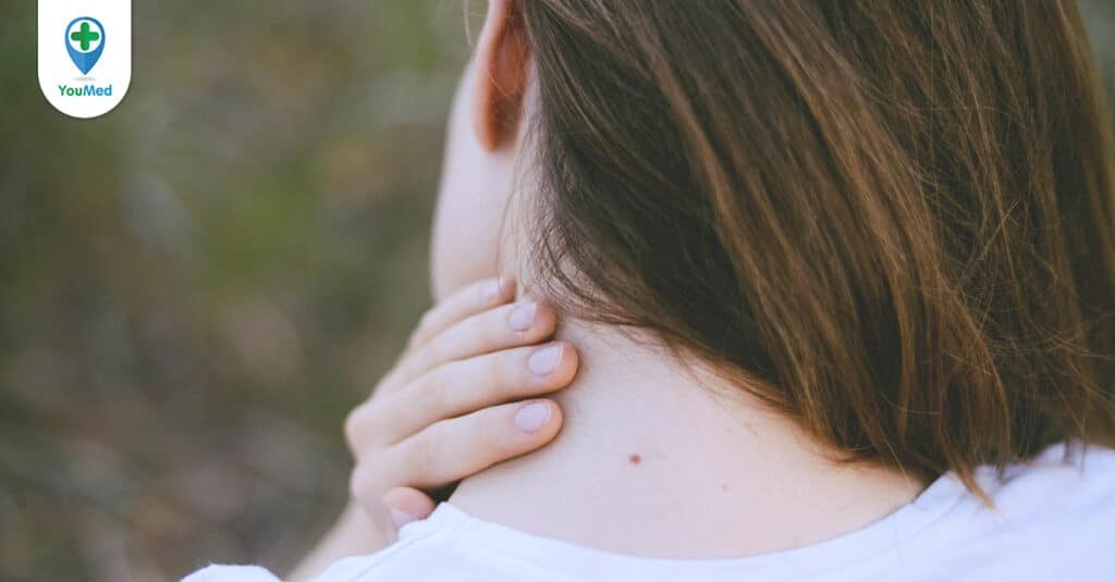 Nổi hạch sau gáy: Sự thật bạn cần biết về dấu hiệu này