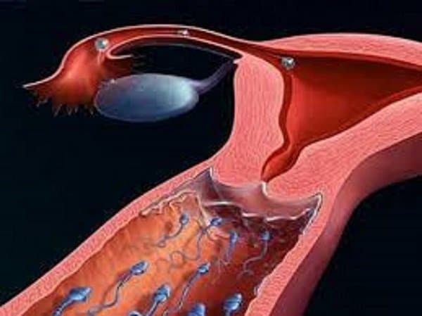 Viêm âm đạo cản trở quá trình di chuyển của tinh trùng