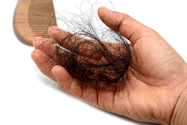 Tóc rụng nhiều là một trong các dấu hiệu cảu suy giáp 