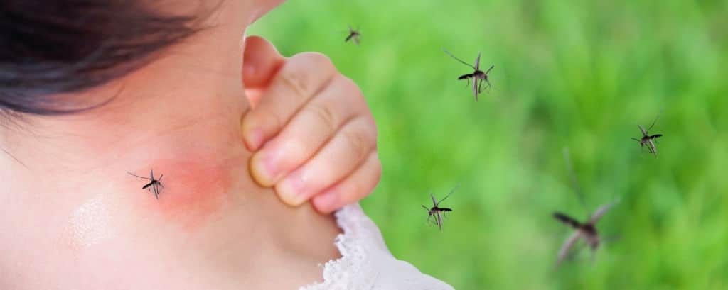 Trẻ bị sốt xuất huyết qua vết muỗi đốt.