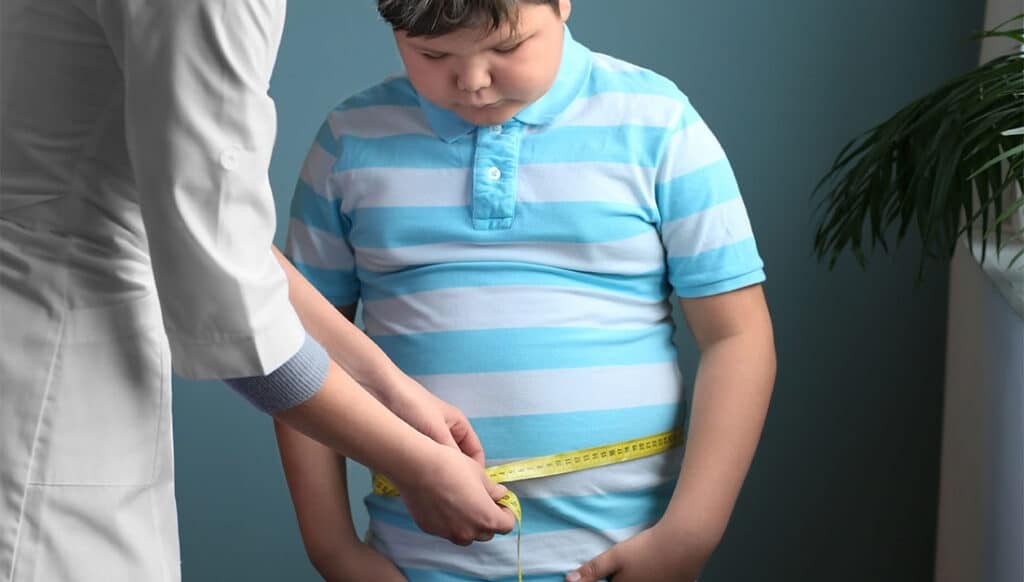 Khi có cân nặng vượt mức bình thường 30%, trẻ có thể bị béo phì