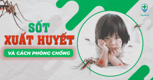 Phòng chống sốt xuất huyết hiệu quả cho trẻ 