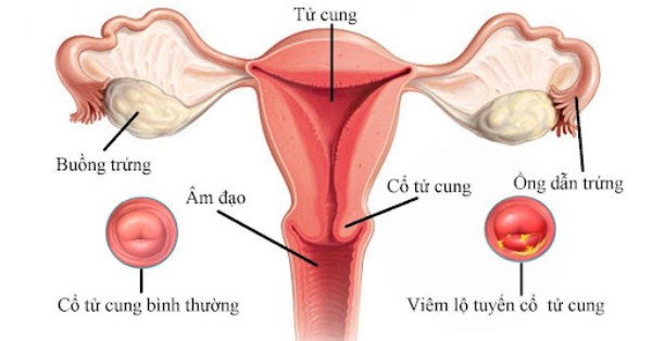 Hình ảnh giải phẫu hệ sinh dục nữ, cổ tử cung là vùng màu xanh da trời