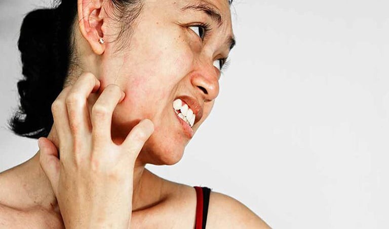 Tại sao bạn cảm thấy ngứa da mặt? Điều trị như thế nào để nhanh hết ngứa?