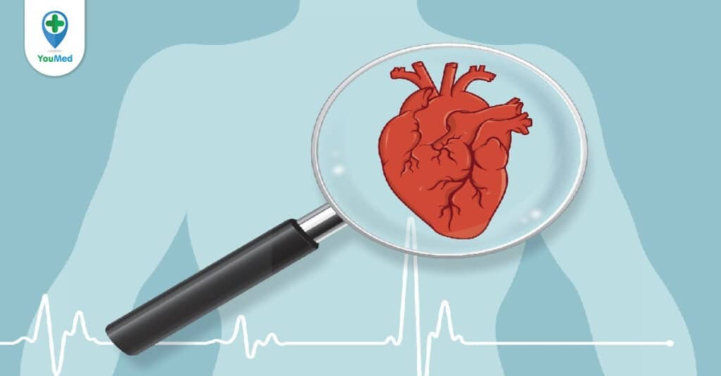 Thiếu máu cơ tim: nguyên nhân, triệu chứng và cách điều trị