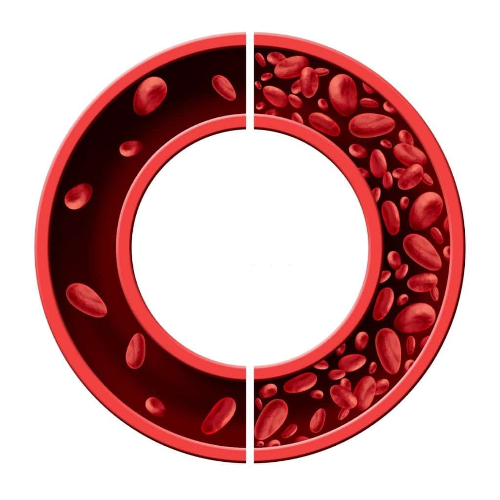 Trẻ bị thiếu máu khi không có đủ hồng cầu để vận chuyển hemoglobin