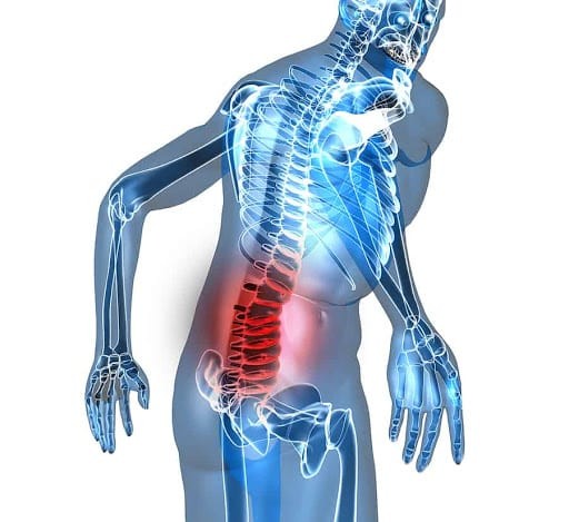 Đau lưng thường do nhiều nguyên nhân khác nhau
