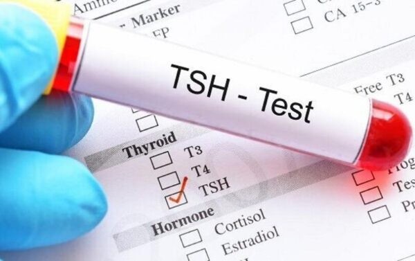 Có ba giá trị tham chiếu của TSH dùng trong việc điều trị. 
