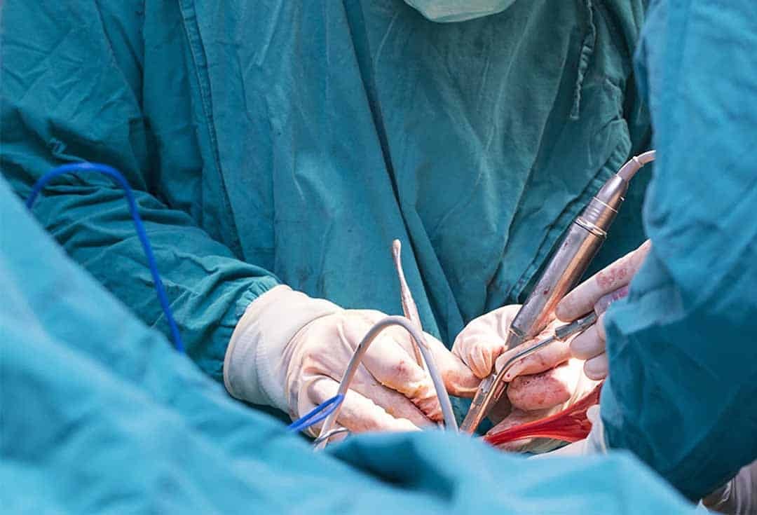 Các phẫu thuật ở vùng liên quan có thể dẫn đến tình trạng xuất tinh khó