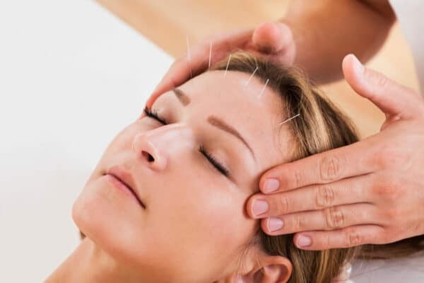 Châm cứu thẫm mỹ kết hợp với massage mặt giúp bảo vệ làn da 