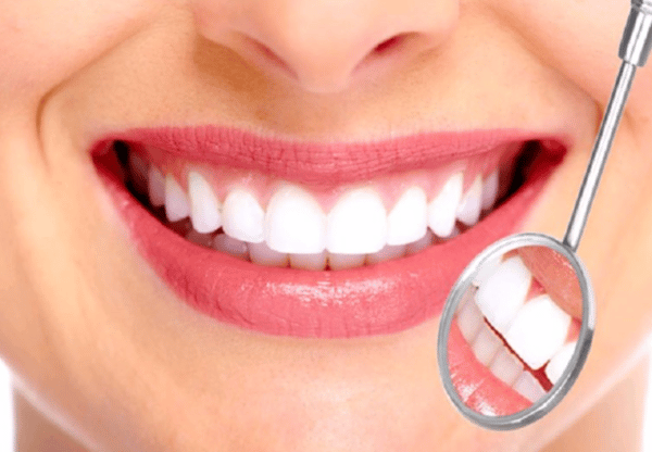 Bọc răng sứ là phương pháp thẩm mỹ răng có kết quả ngay khi điều trị