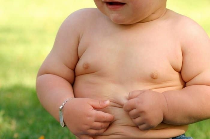 Tăng cân quá mức là một trong những dẫu hiệu của hội chứng Cushing ở trẻ em
