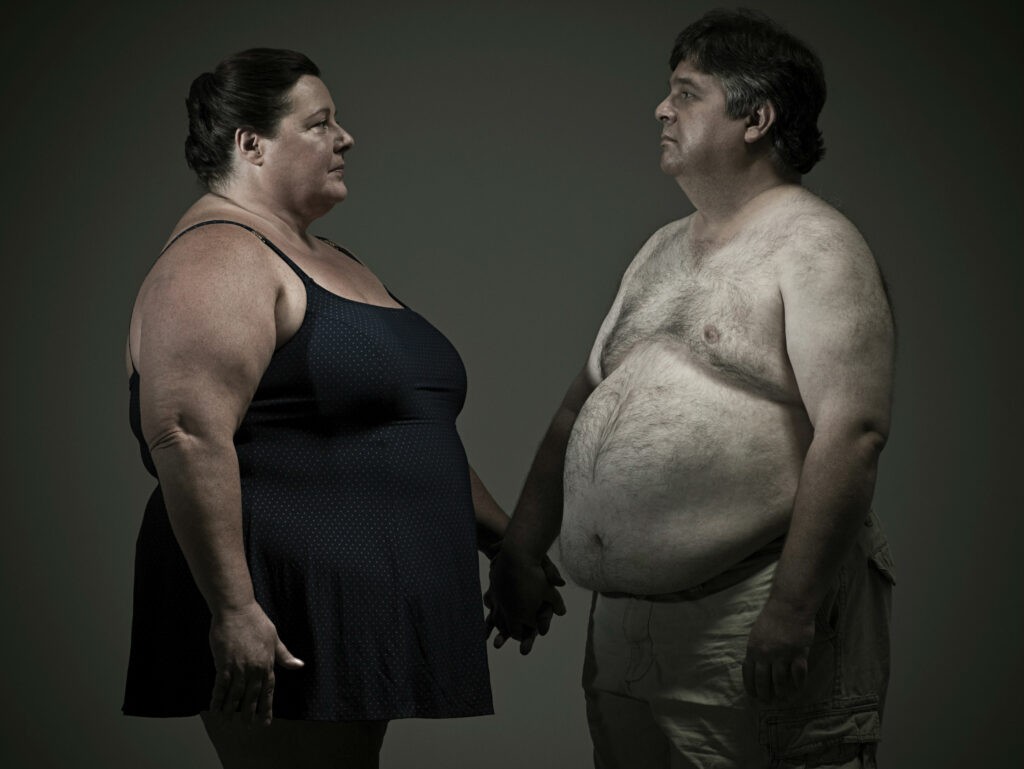 Người bị béo phì là yếu tố nguy cơ cao của bệnh
