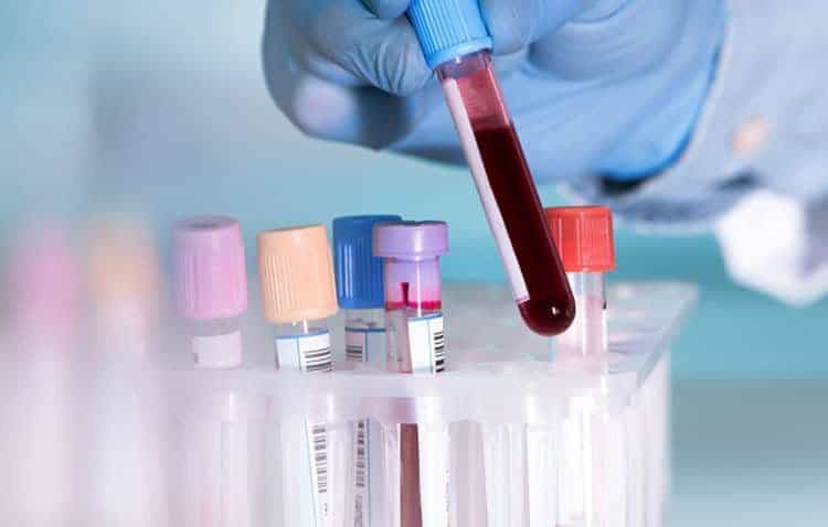Xét nghiệm máu là một phần quan trọng trong chẩn đoán