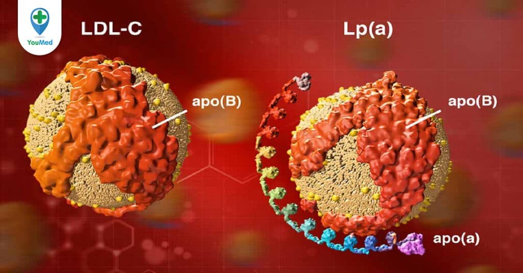 Rối loạn chuyển hóa lipoprotein: cách nhận diện và xác định nguyên nhân