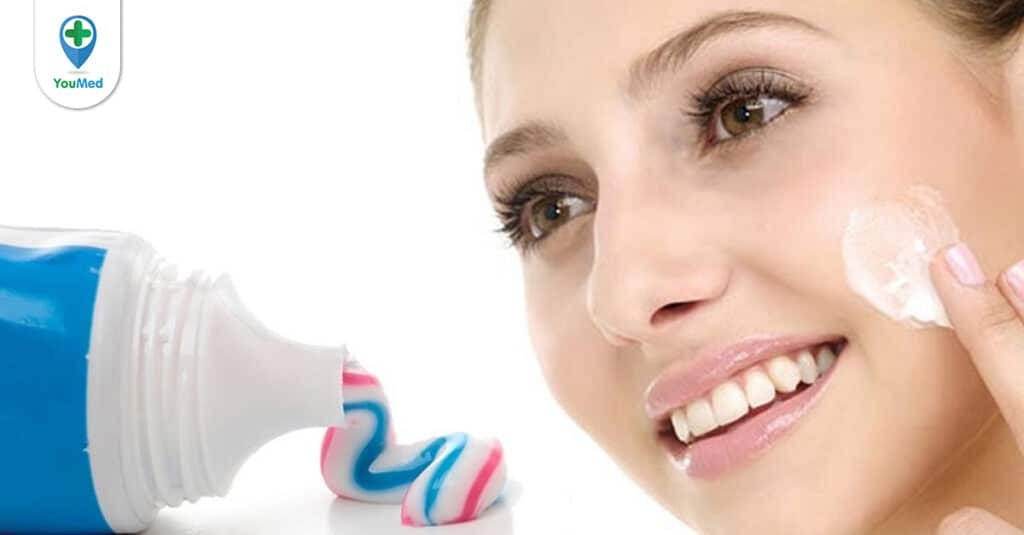 Trị mụn bằng kem đánh răng có tốt không?