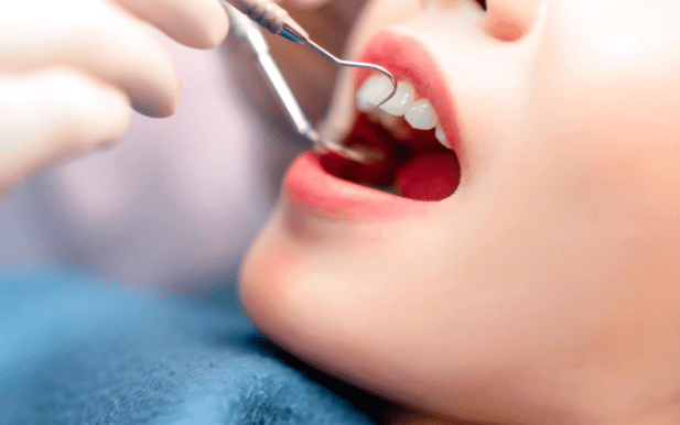 Điều trị áp xe răng