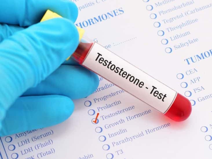 Xét nhiệm Testosterone giúp xác định tình trạng rối loạn nội tiết tố ở nam giới