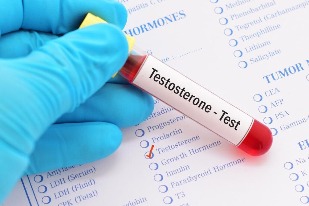 Testosterone là xét nghiệm hormon giới tính nam