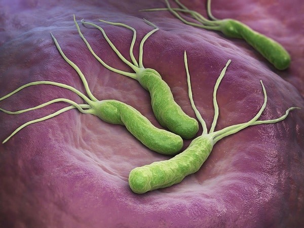 Vi khuẩn H. pylori gây loét dạ dày và tá tràng