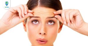 Co giật mí mắt lành tính