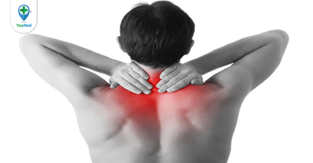 Gai cột sống cổ: Nguyên nhân, chẩn đoán và điều trị 