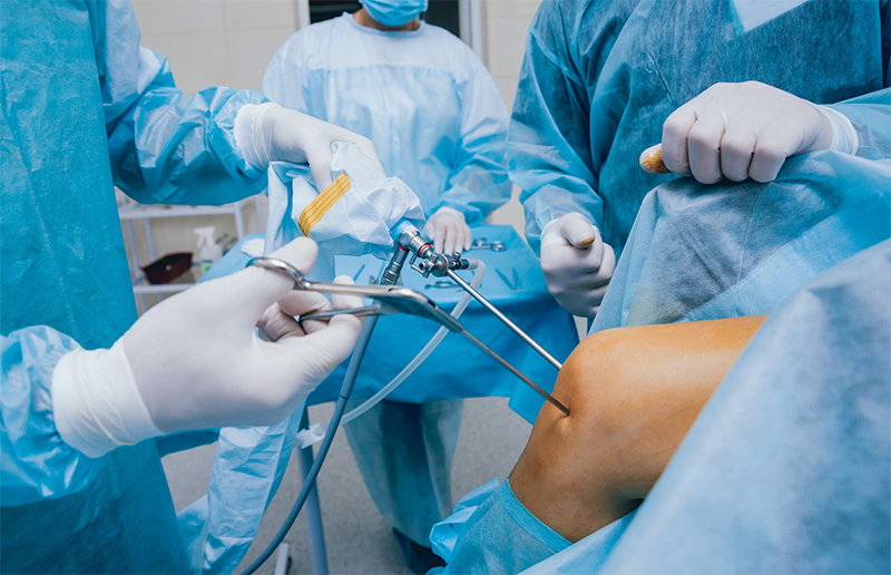 Bệnh nhân có thể được chỉ định phẫu thuật nội soi để loại bỏ các gai xương