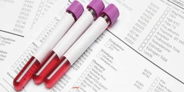 Chẩn đoán ung thư gan qua các chỉ số xét nghiệm máu