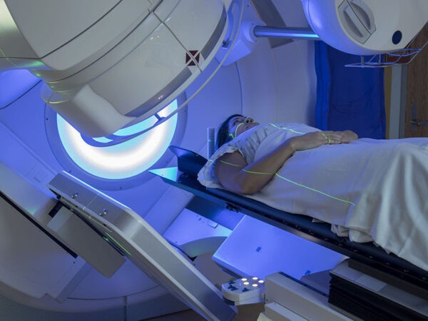 Phương pháp xạ trị sử dụng các tia tiêu diệt từng tế bào ung thư gan