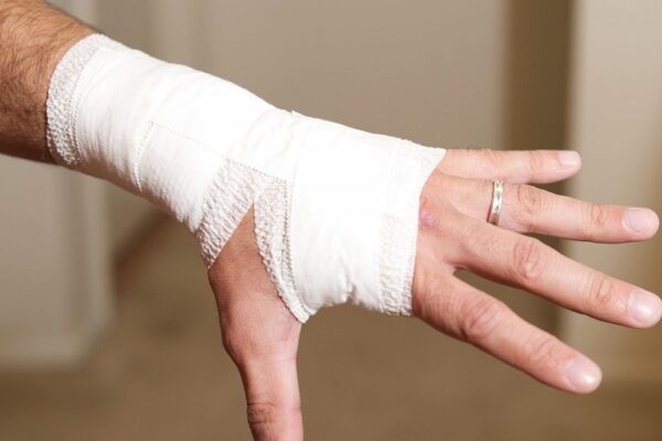 Bong gân có thể là nguyên nhân khiến bạn bị đau cánh tay