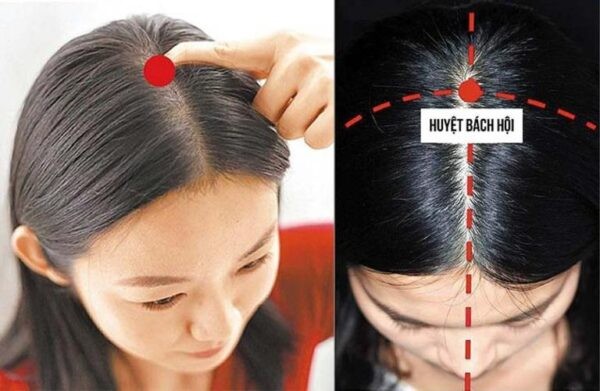 Bấm huyệt Bách hội thường xuyên giúp tăng cường lưu thông máu nuôi dưỡng tóc