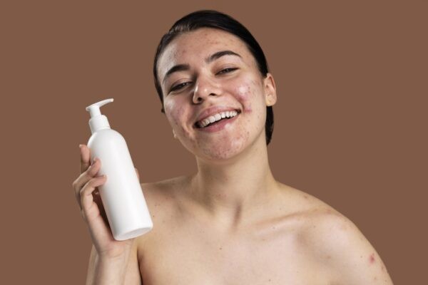 Sử dụng sữa rửa mặt dịu nhẹ cho da sau khi nặn mụn