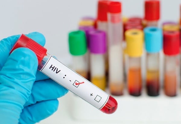 Quan hệ tình dục không an toàn với người nhiễm HIV có thể làm tăng nguy cơ bị lây nhiễm bệnh