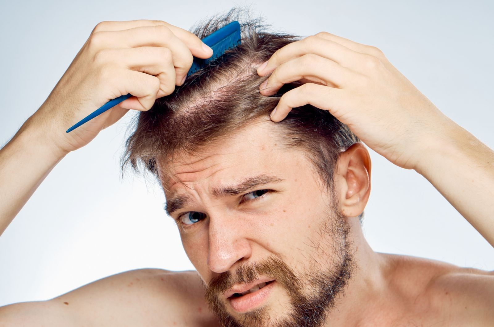 Viên uống dưỡng tóc Hair Volume của New Ordic phù hợp cho cả nam và nữ