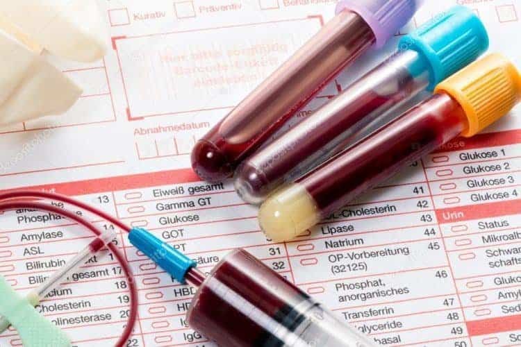 kiểm tra công thức máu còn giúp theo dõi tình trạng bệnh lý, kiểm soát các nguy cơ khi sử dụng thuốc ảnh hưởng đến tế bào máu