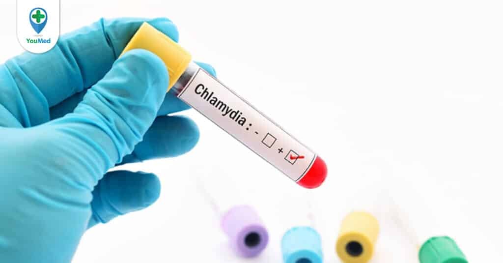 Tầm quan trọng của xét nghiệm Chlamydia bạn cần biết