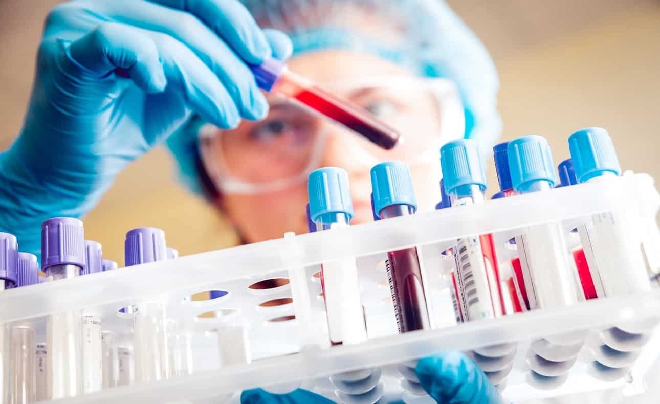 Mẫu máu sẽ được đưa đến phòng thí nghiệm để bác sĩ phân tích và đưa ra kết quả