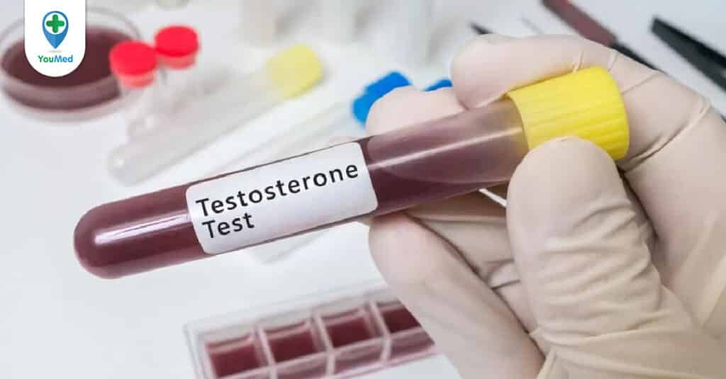 Ý nghĩa xét nghiệm testosterone đối với nam giới