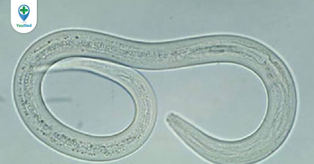 Xét nghiệm chẩn đoán bệnh ấu trùng giun lươn