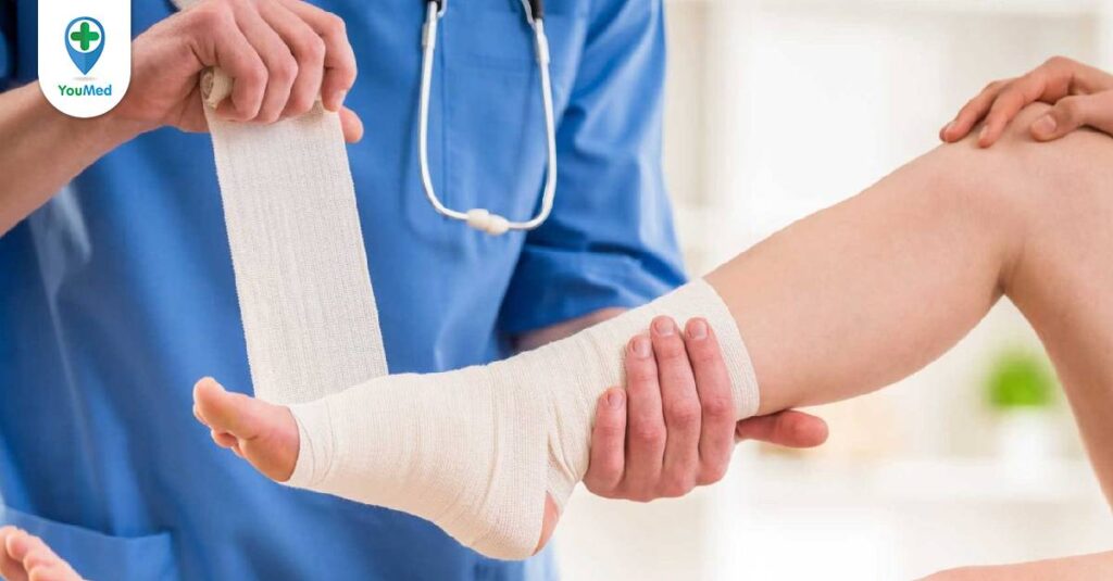 Bong gân: Nguyên nhân, triệu chứng và cách điều trị